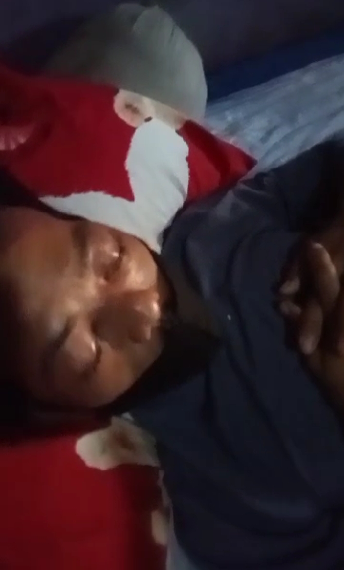 Bola Matanya Bengkak dan Mengeluarkan Cairan Kuning, Riki Butuh Uluran Tangan Dinas Terkait Bola Matanya Bengkak dan Mengeluarkan Cairan Kuning, Riki Butuh Uluran Tangan Dinas Terkait